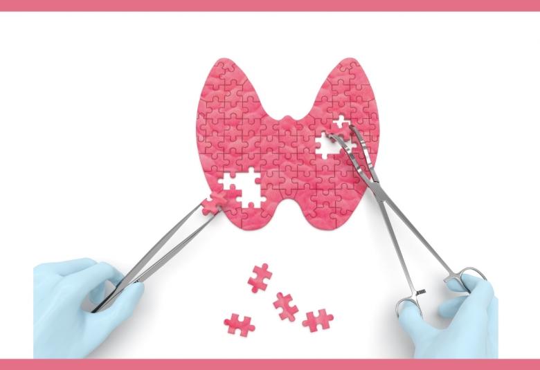 THYROID DYSFUNCTIONS