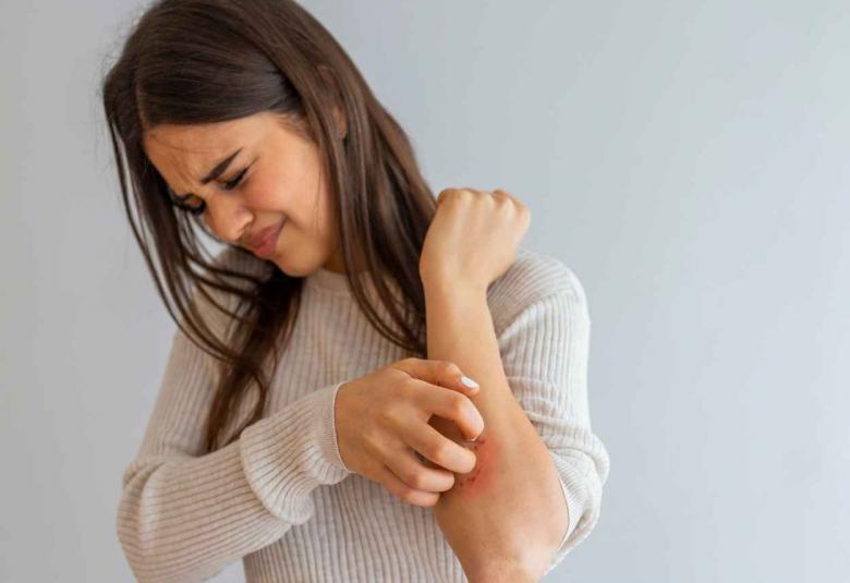 Leo Pharma gets CHMP nod for Adtralza for dermatitis