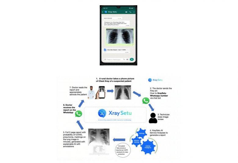 AI-driven XraySetu to facilitate early COVID detection