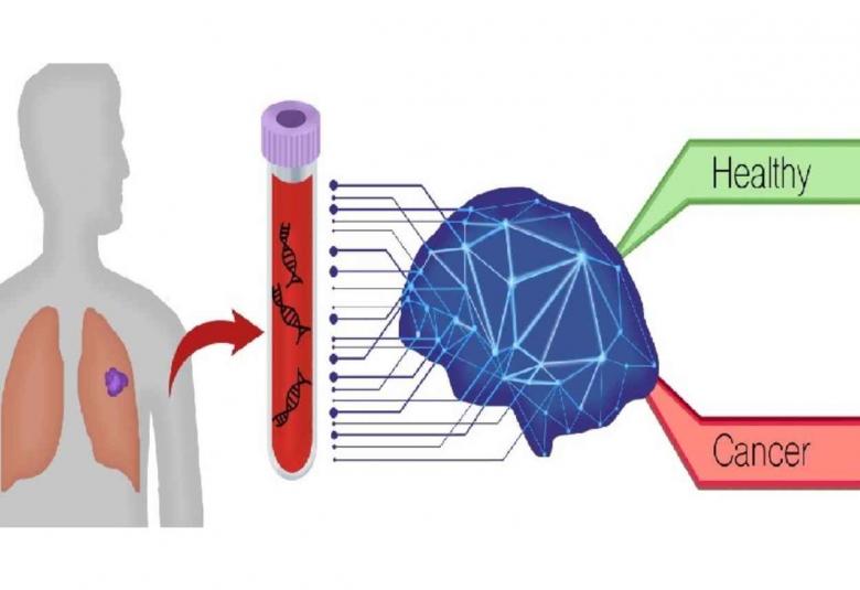 Novel AI Blood Testing Technology Can ID Lung Cancers with High Accuracy
