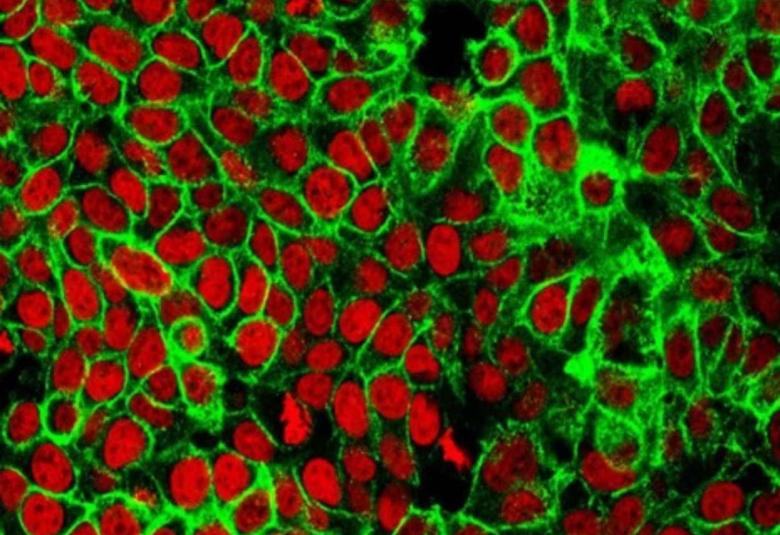 Scientists discover a new way to detect early colon cancer