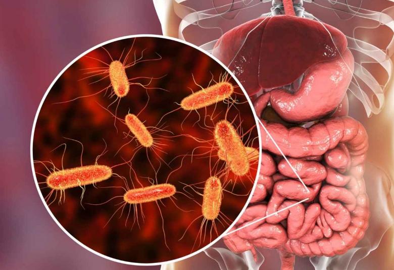 Systemic lupus erythematosus linked to altered gut microbiome