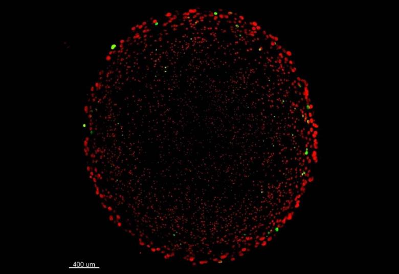 Researchers discover new hiding place for antibiotic resistance