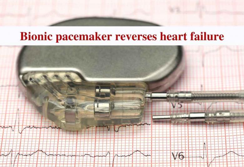 Bionic pacemaker reverses heart failure