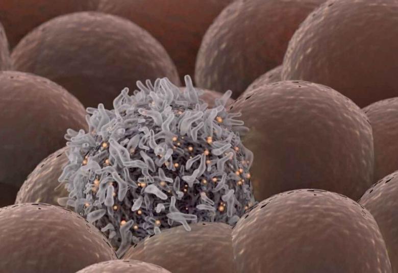 Technology Developed at UH Could Advance Treatment of Lymphoma