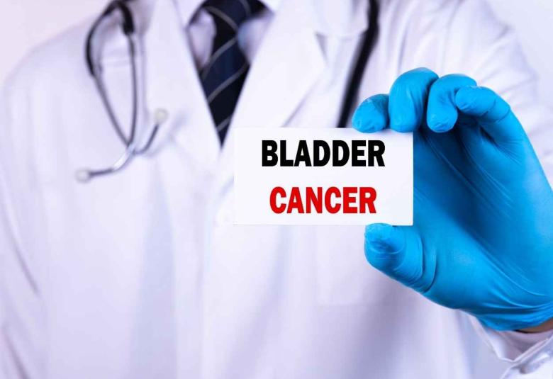 Researchers identify immune cell that helps kill bladder cancer tumors