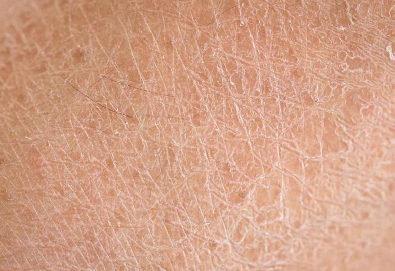 Uncovering the skin’s secrets
