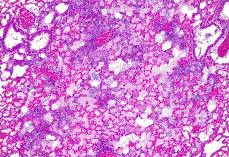 First living medicine created to treat drug resistant lung infections