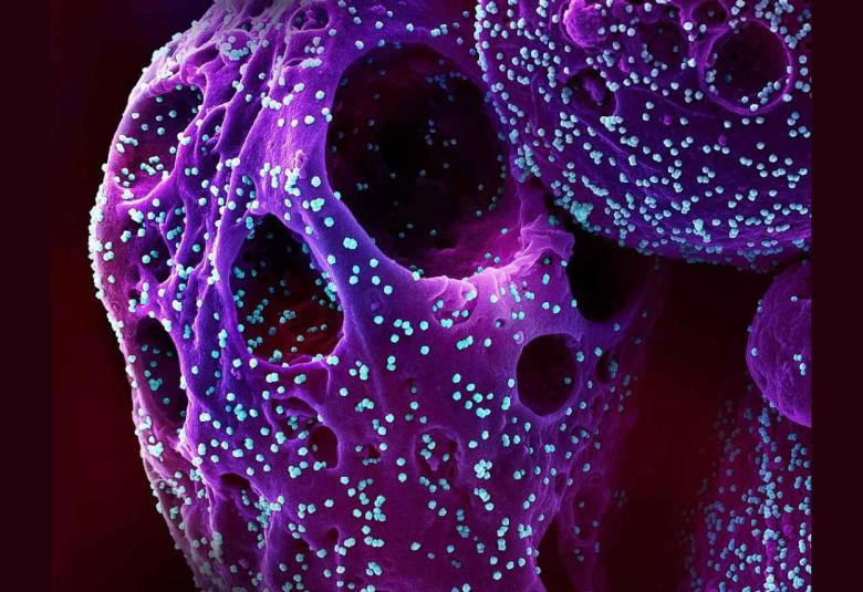 NIH RECOVER research identifies potential long COVID disparities