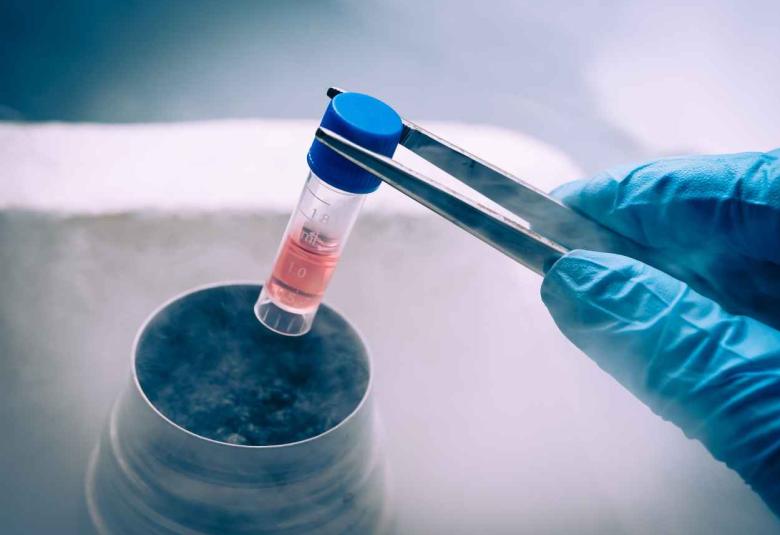 Stem cell transplantation can kill HIV, suggests research