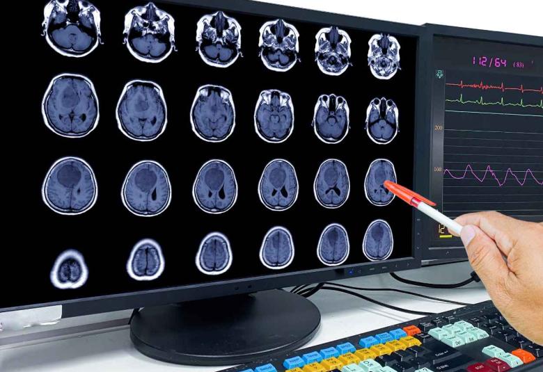Dana-Farber Leads Adaptive, Efficient Multi-arm Phase 2 Clinical Trial for Glioblastoma