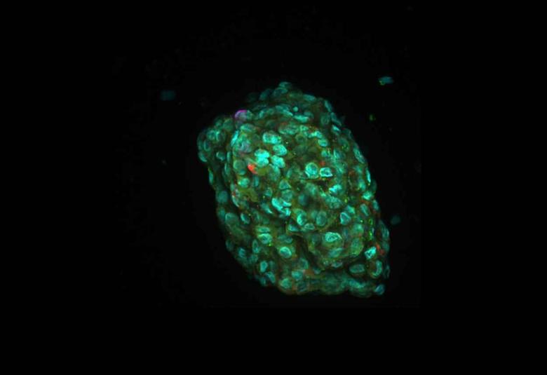 Personalized cancer medicine