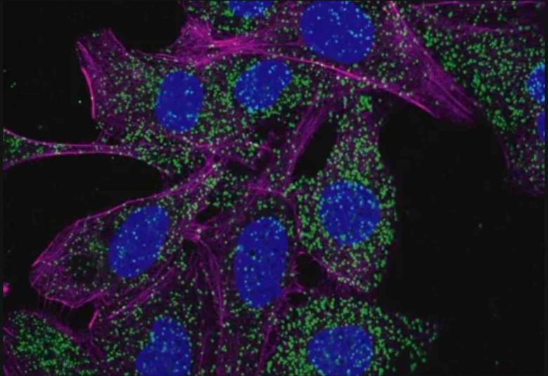 Leukemia cells activate cellular recycling program