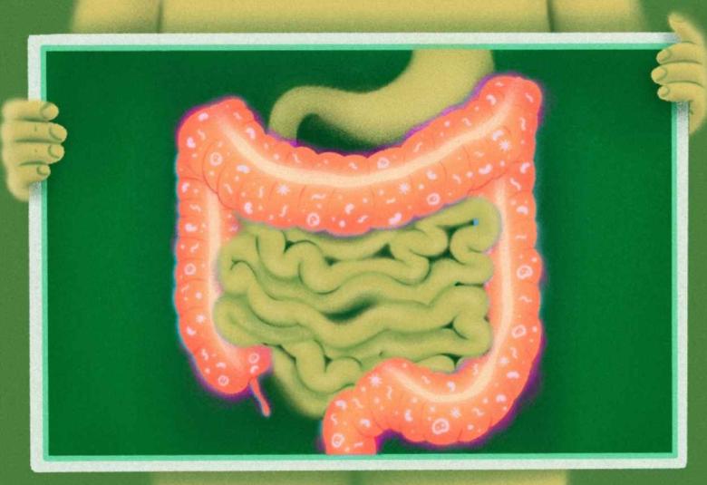 Researchers identify why cancer immunotherapy can cause colitis