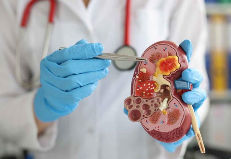 Novo Nordisk announced results from the kidney outcomes trial FLOW