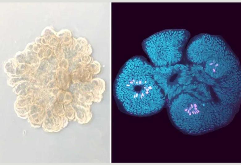 New study demonstrates the efficacy of a promising celiac disease drug at the molecular level