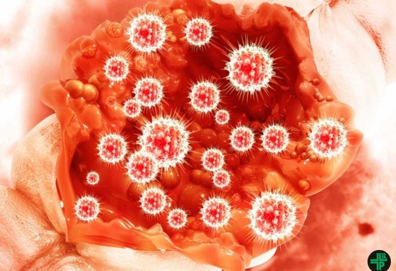 Combination of dual-targeted therapies and chemotherapy shows high response rates in BRAF-mutated metastatic colorectal cancer