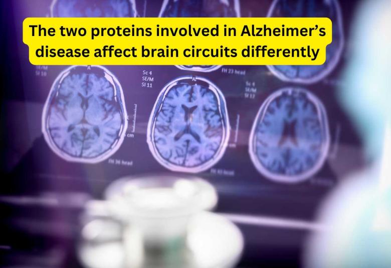 The two proteins involved in Alzheimer’s disease affect brain circuits differently
