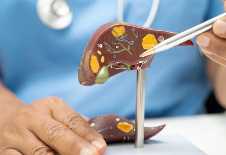 Molecular markers and risk models guide precision care in liver cancer surgery