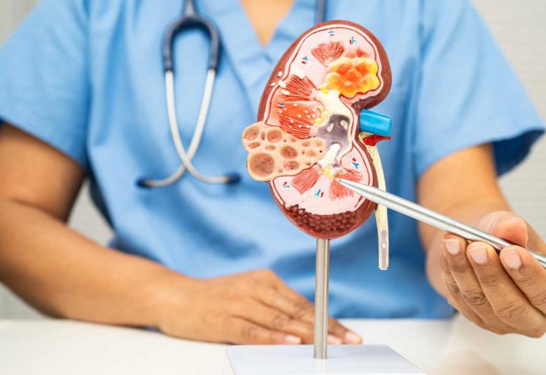 The Forgotten Half of Diabetic Kidney Disease Finally Gets Its Own Trial and the Results Are Positive