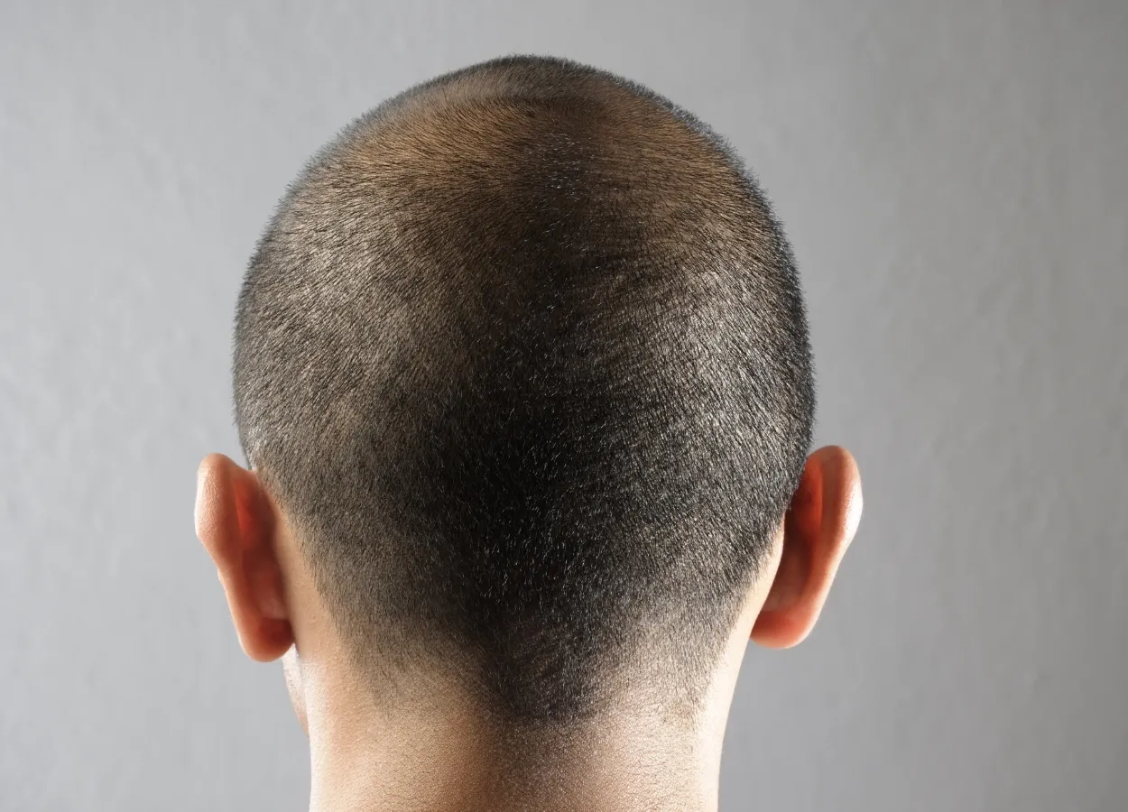 New combo therapy for head and neck cancer