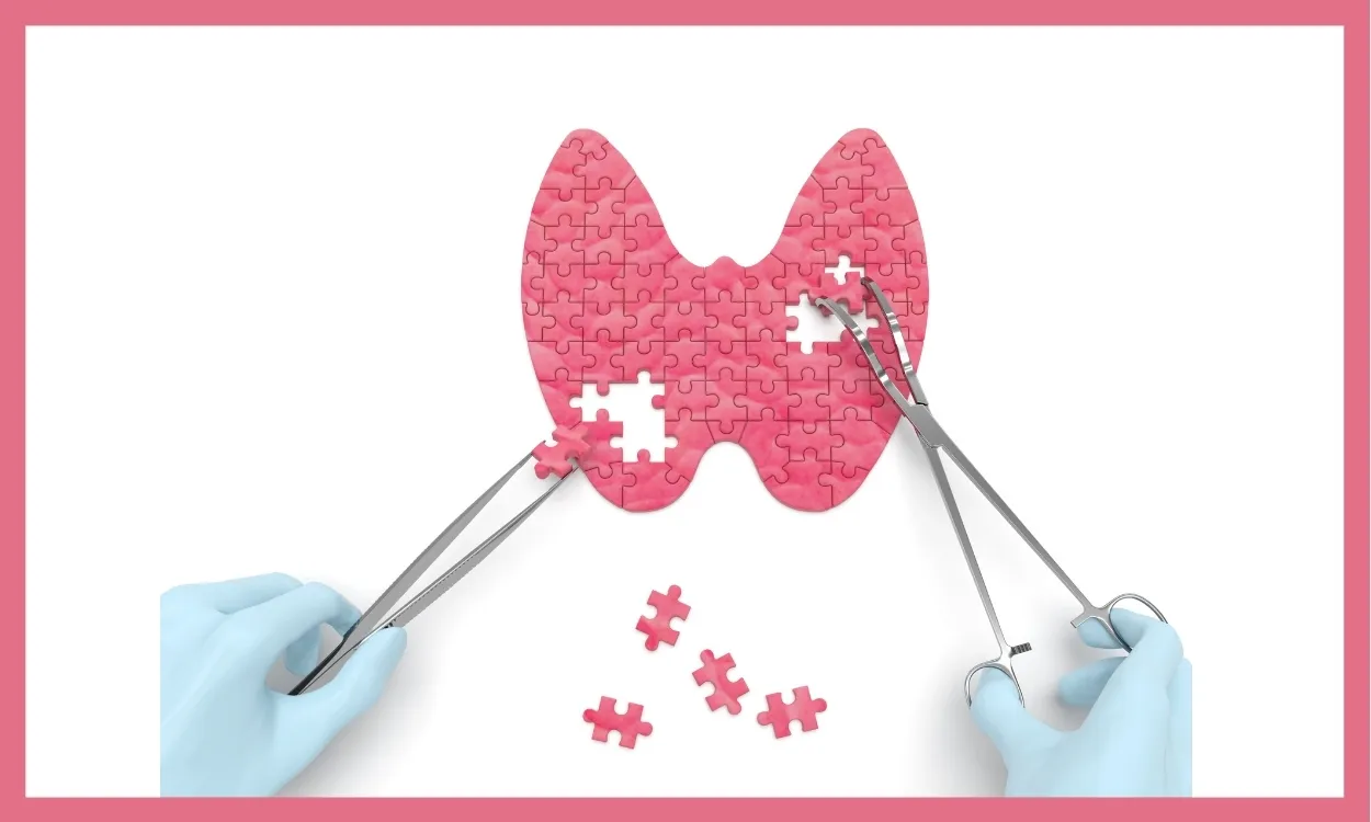 THYROID DYSFUNCTIONS