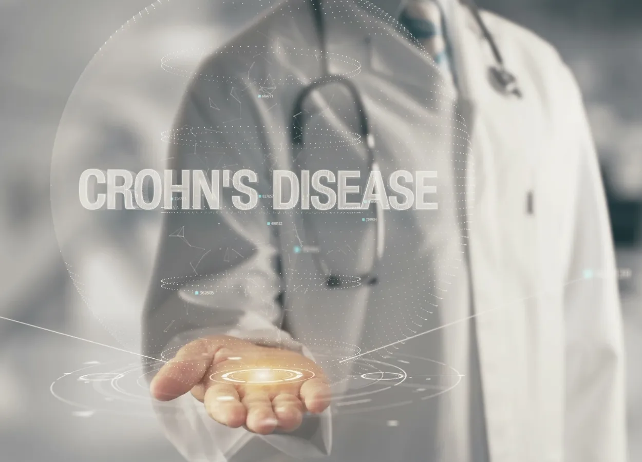 New potential therapy for Crohns disease in children