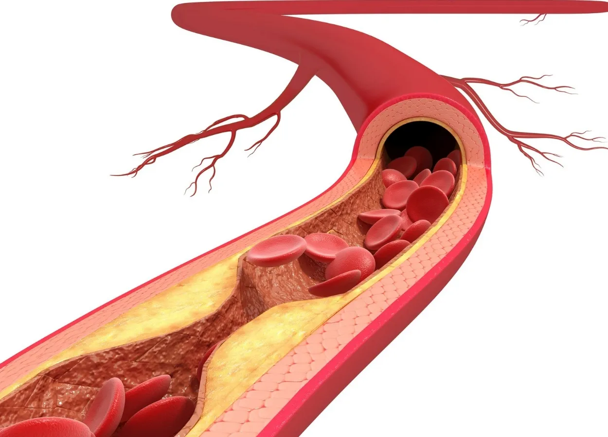 New synthetic peptides could attenuate atherosclerosis