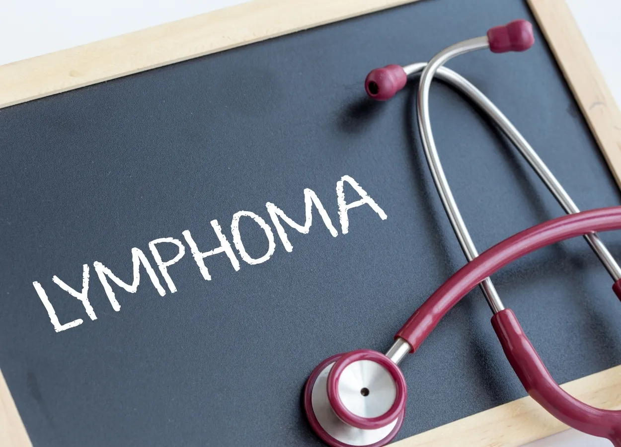 refractory lymphomas