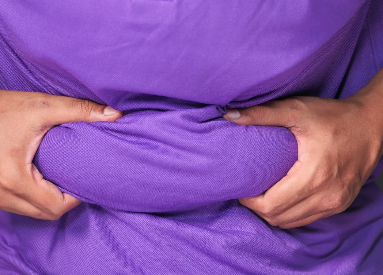 High Liver Fat (Hepatic Steatosis) Linked to Increased Risk of Hospitalization in COVID-19 Patients With Obesity