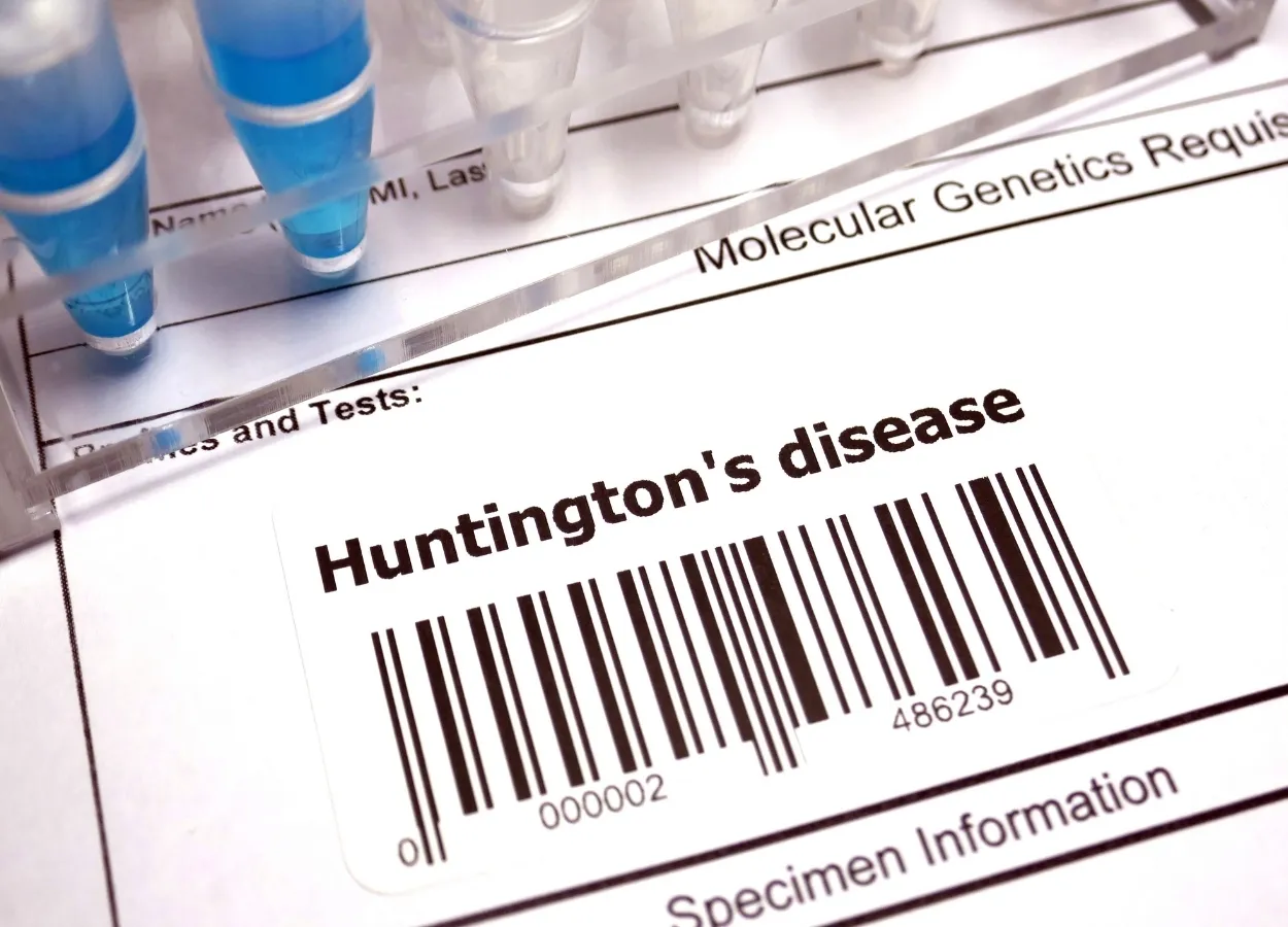 Huntingtons disease driven by slowed protein-building machinery in cells