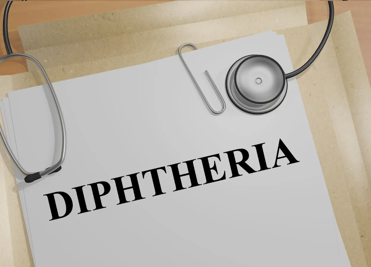 Study warns Diphtheria could become a major global threat