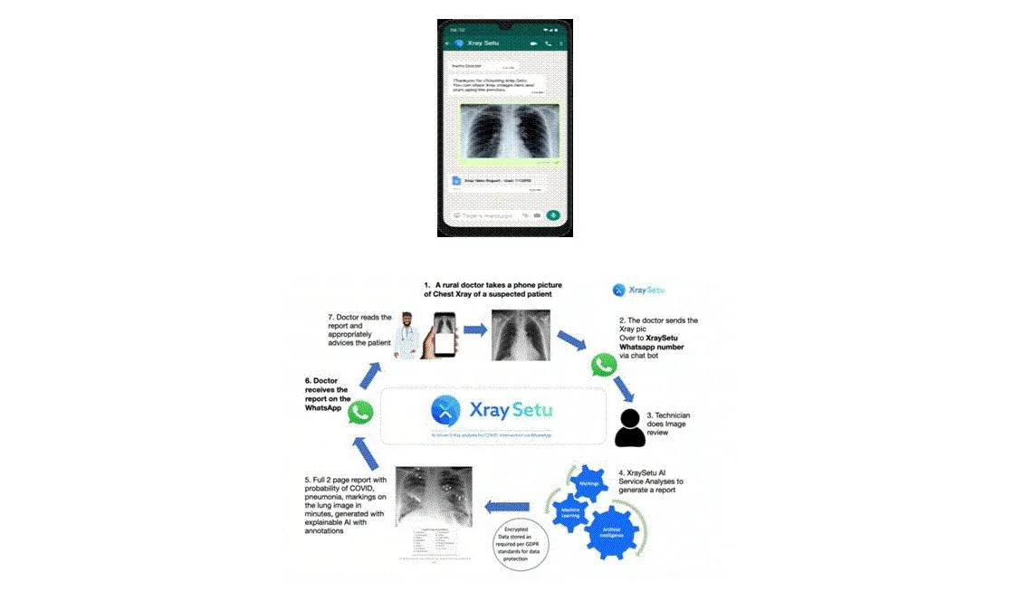 AI-driven XraySetu to facilitate early COVID detection