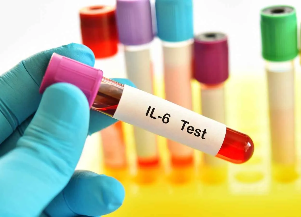 WHO recommends IL6 receptor blockers for COVID-19