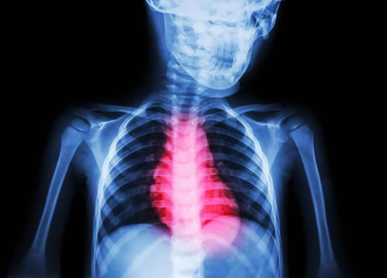 Is it possible to personalise sudden cardiac death prevention after myocardial infarction
