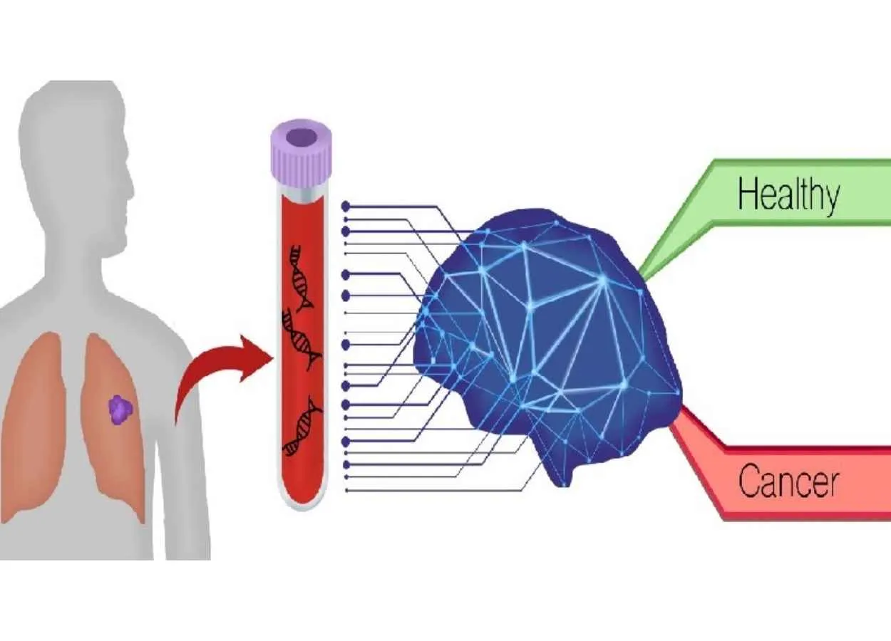 Novel AI Blood Testing Technology Can ID Lung Cancers with High Accuracy