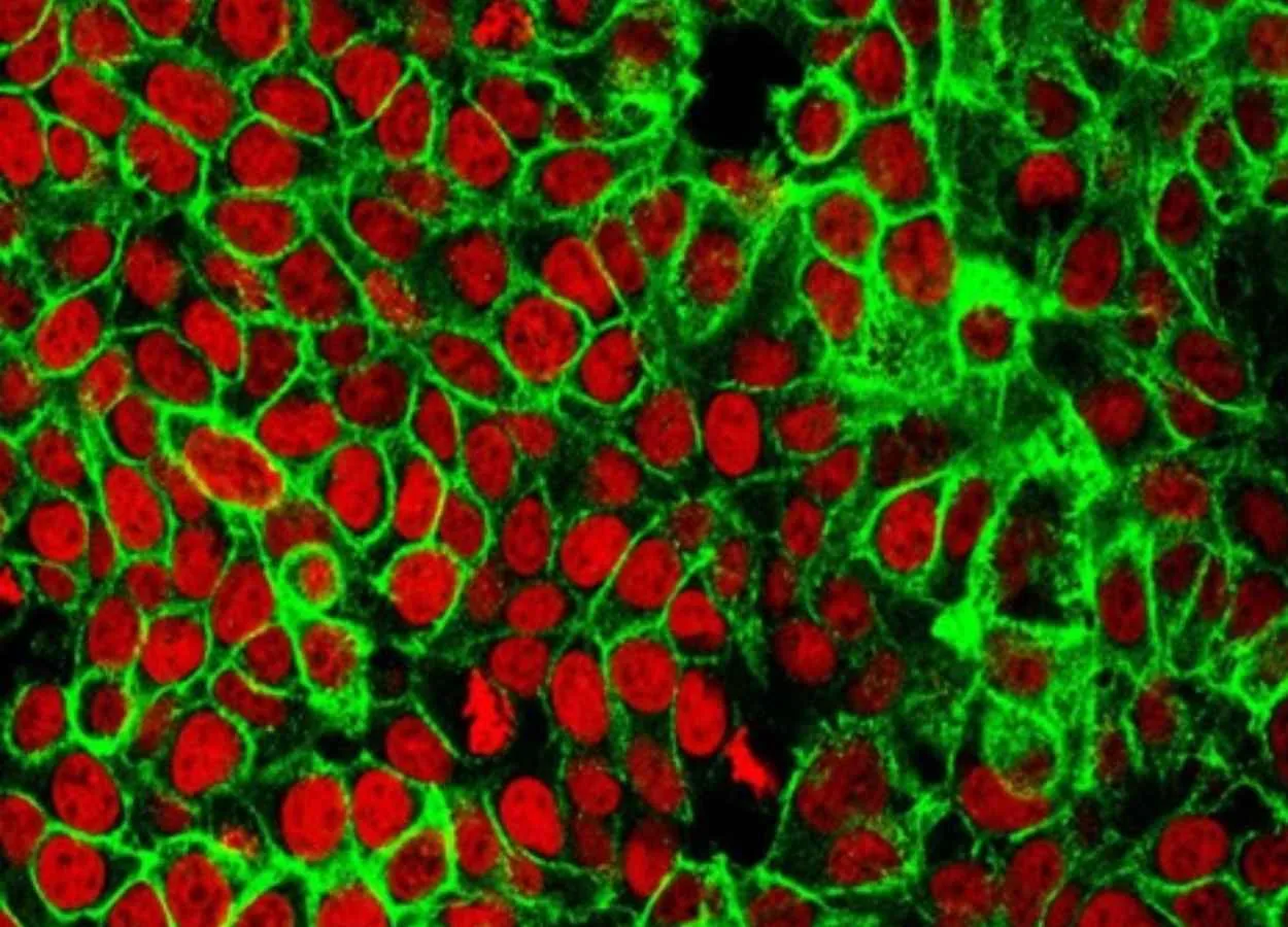 Scientists discover a new way to detect early colon cancer
