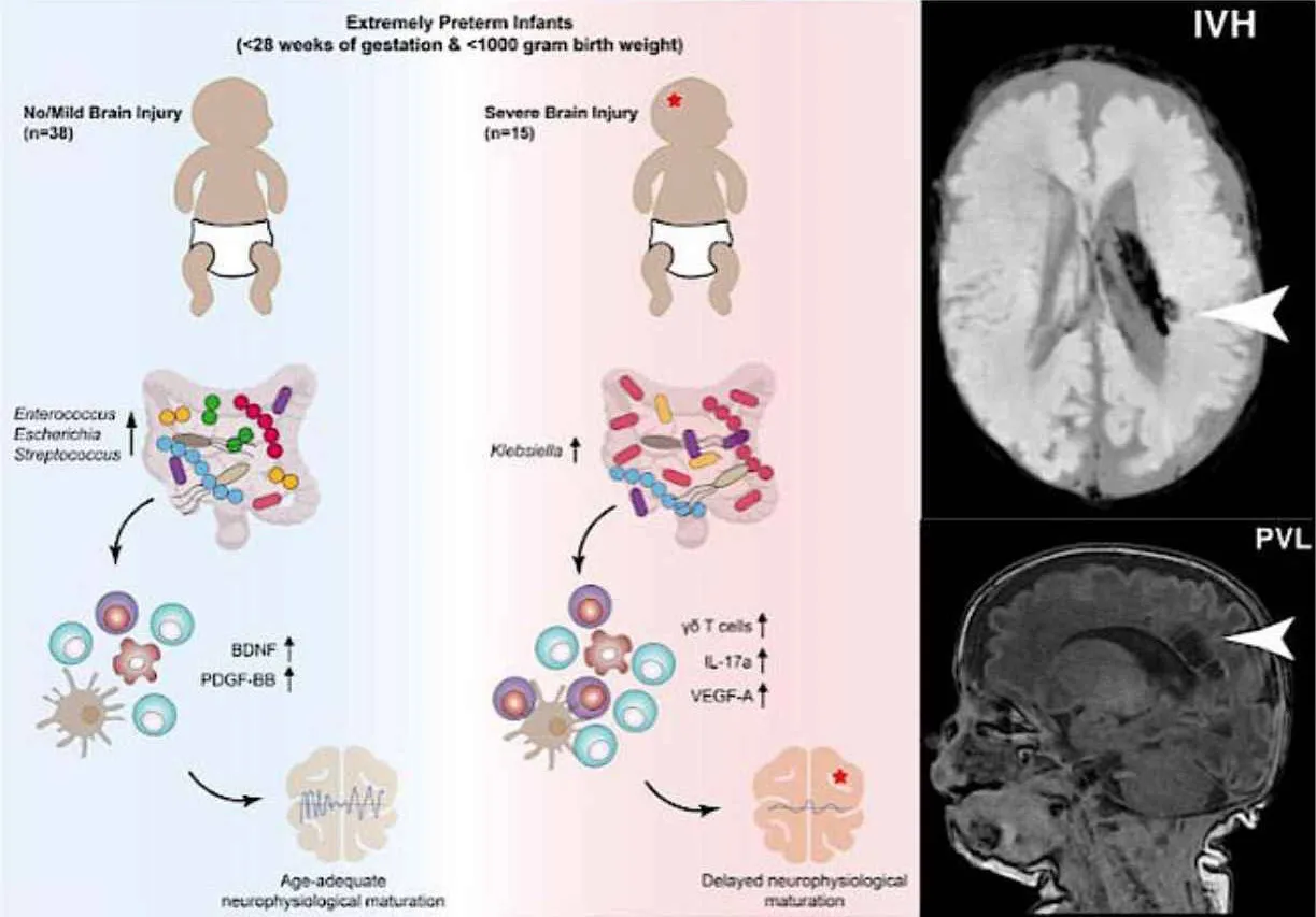 Gut bacteria influence brain development