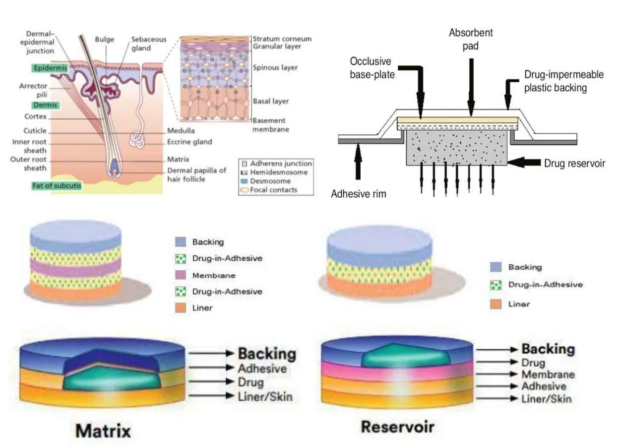 Transdermal Drug Delivery System A Review Article 50 OFF   Transdermal Drug Delivery System A Review Article .webp