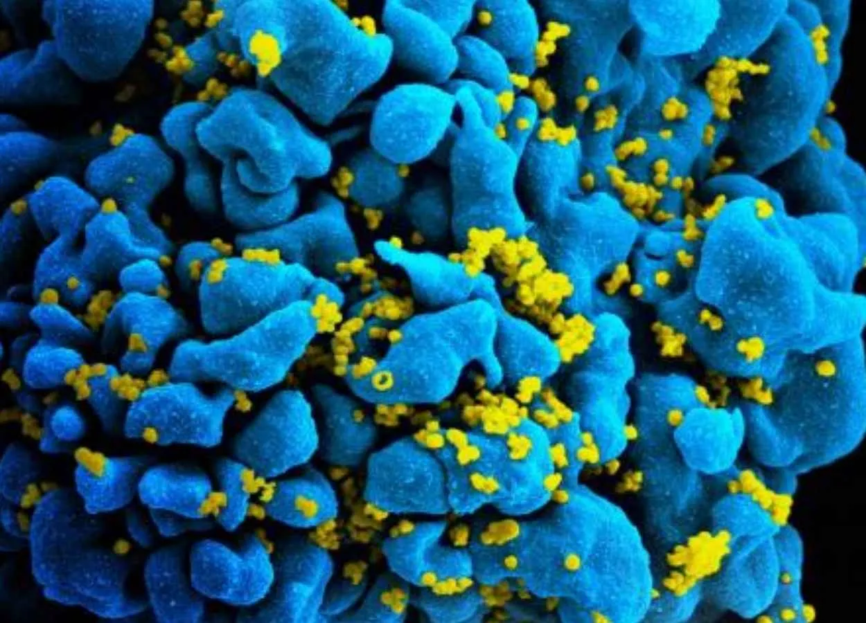 Researchers Identify How Two People Controlled HIV After Stopping Treatment