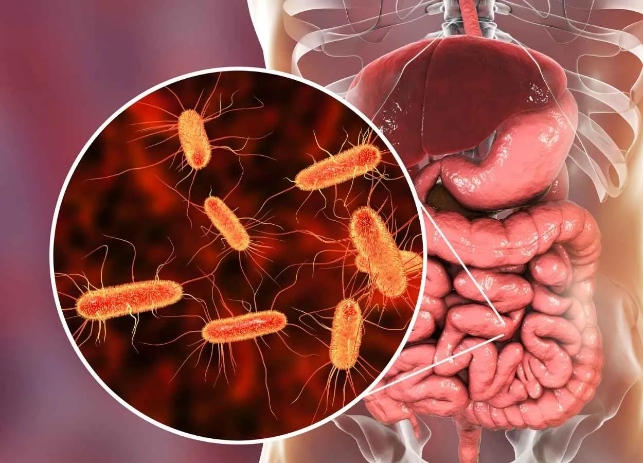 Systemic lupus erythematosus linked to altered gut microbiome