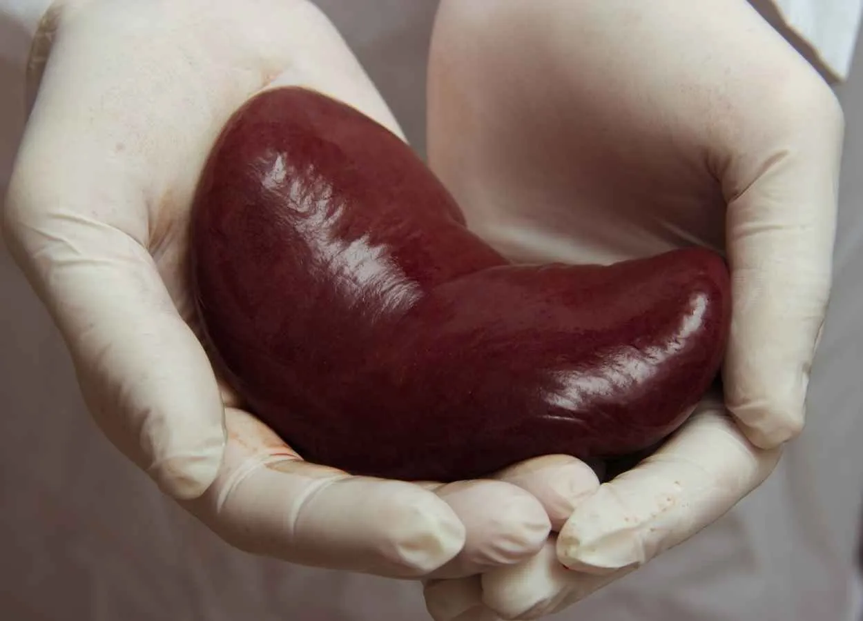 Vifor Pharma andAngion Biomedica Corp announced that the phase-III trial of Angions ANG-3777 