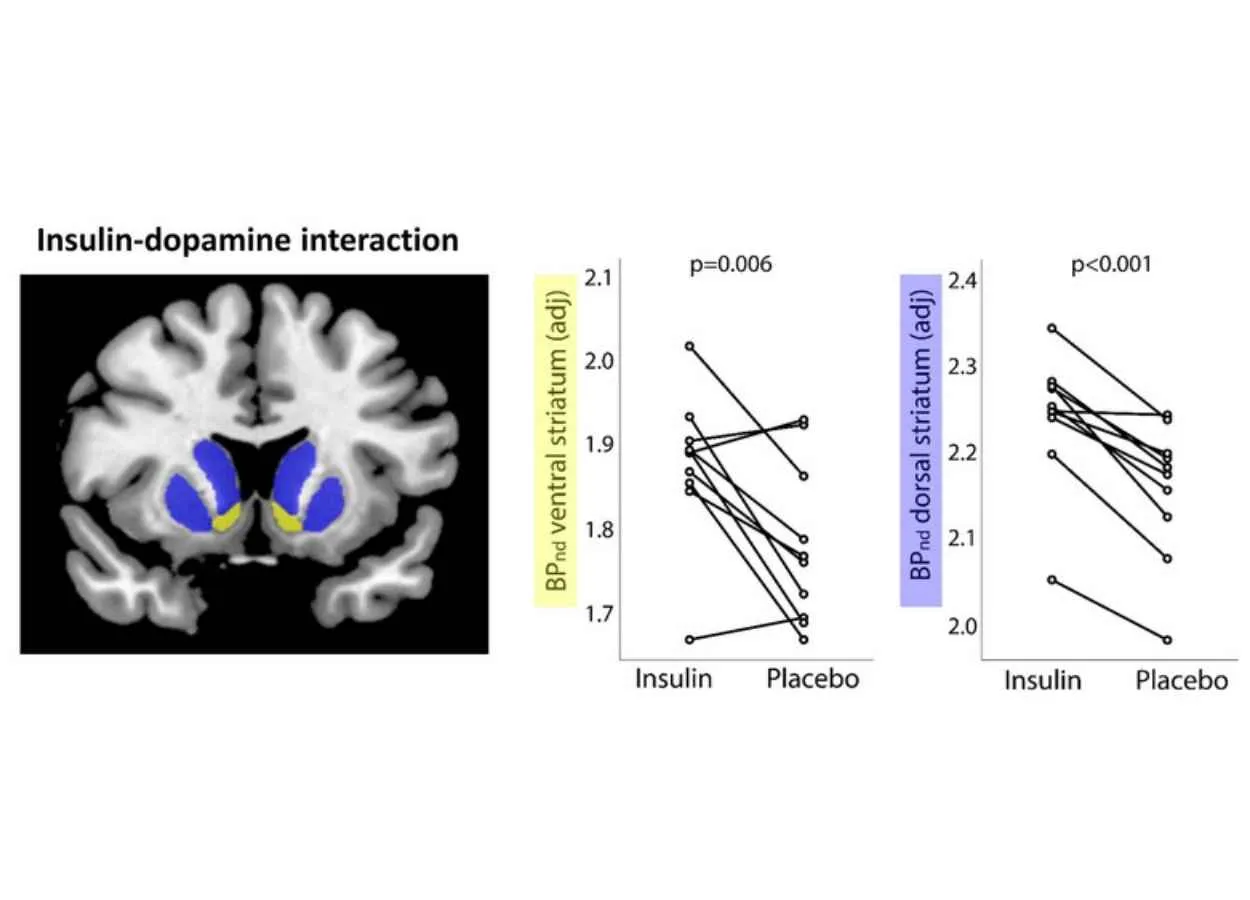 Insulin in the Brain Influences Dopamine Levels