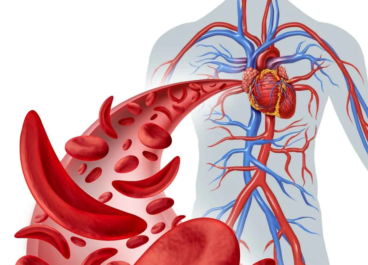 First patient enrolled in phase-IIa study of vamifeport in patients with sickle cell disease