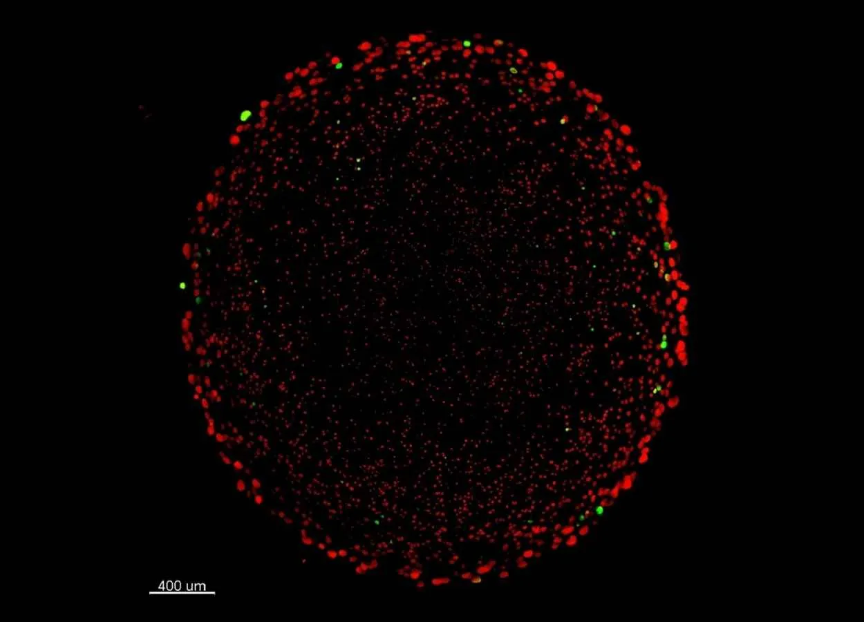 Researchers discover new hiding place for antibiotic resistance