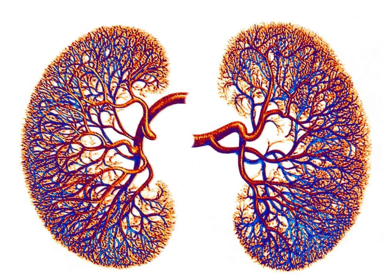 Vifor Pharma and Angion report topline results from phase-II GUARD trial of ANG-3777 in cardiac surgery associated acute kidney injury