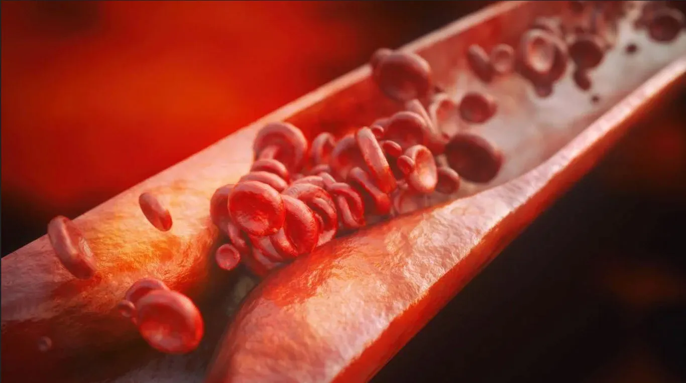 Macrophages are fighting against plaque formation in the artery