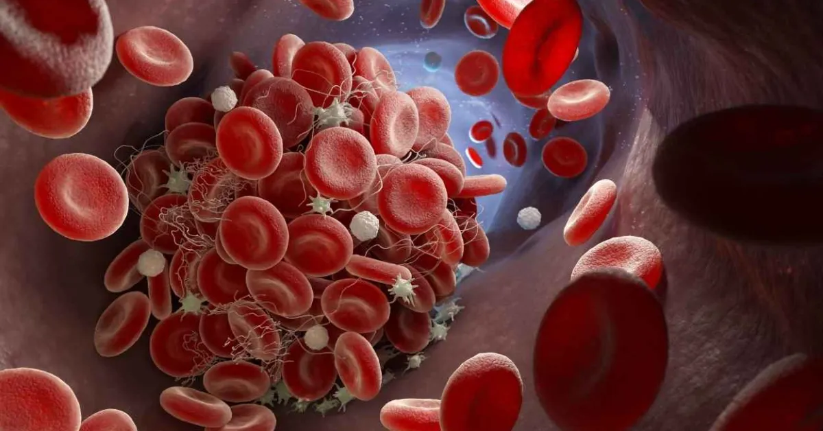 FDA approves Enjaymo, first treatment for use in patients with cold agglutinin disease