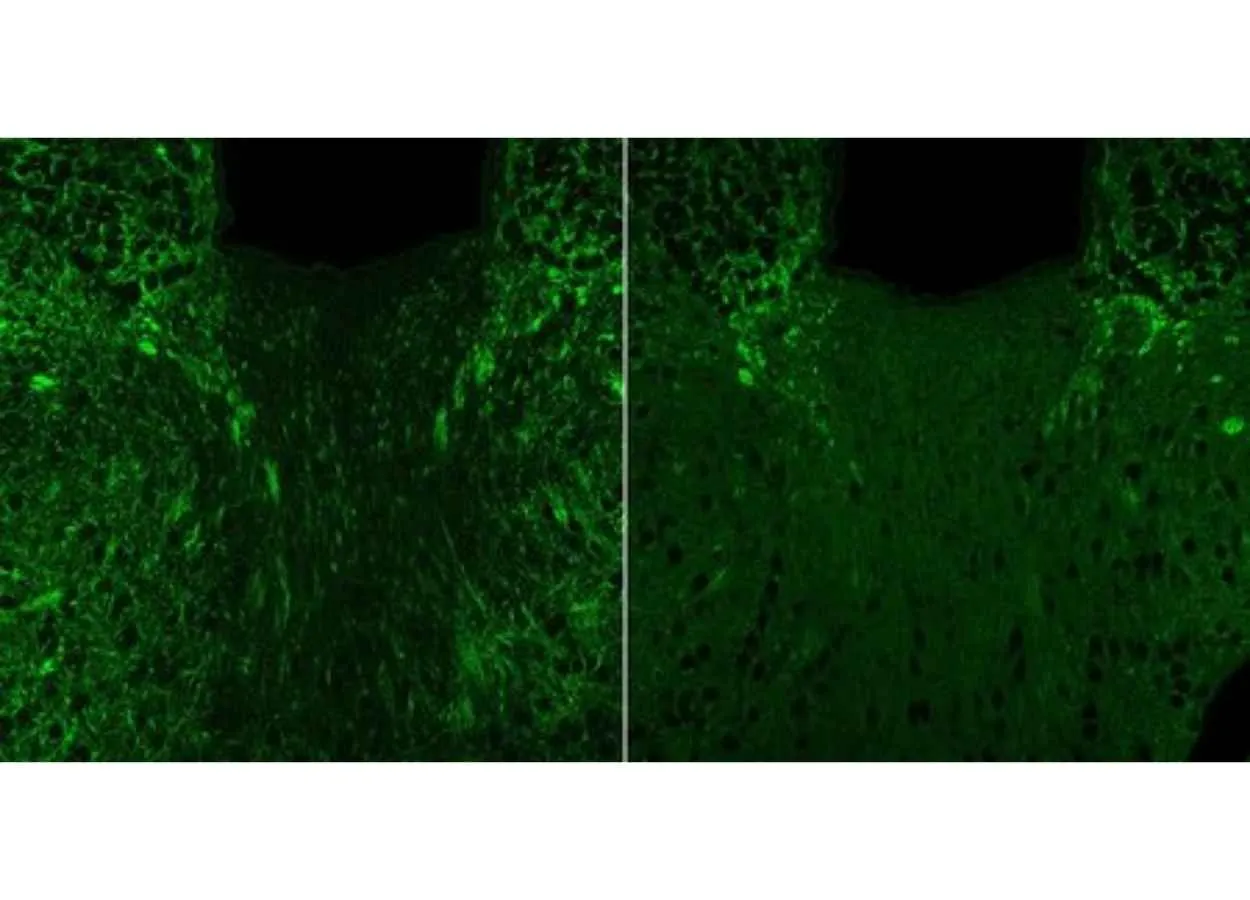 A Microbial Compound in the Gut Leads to Anxious Behaviors in Mice