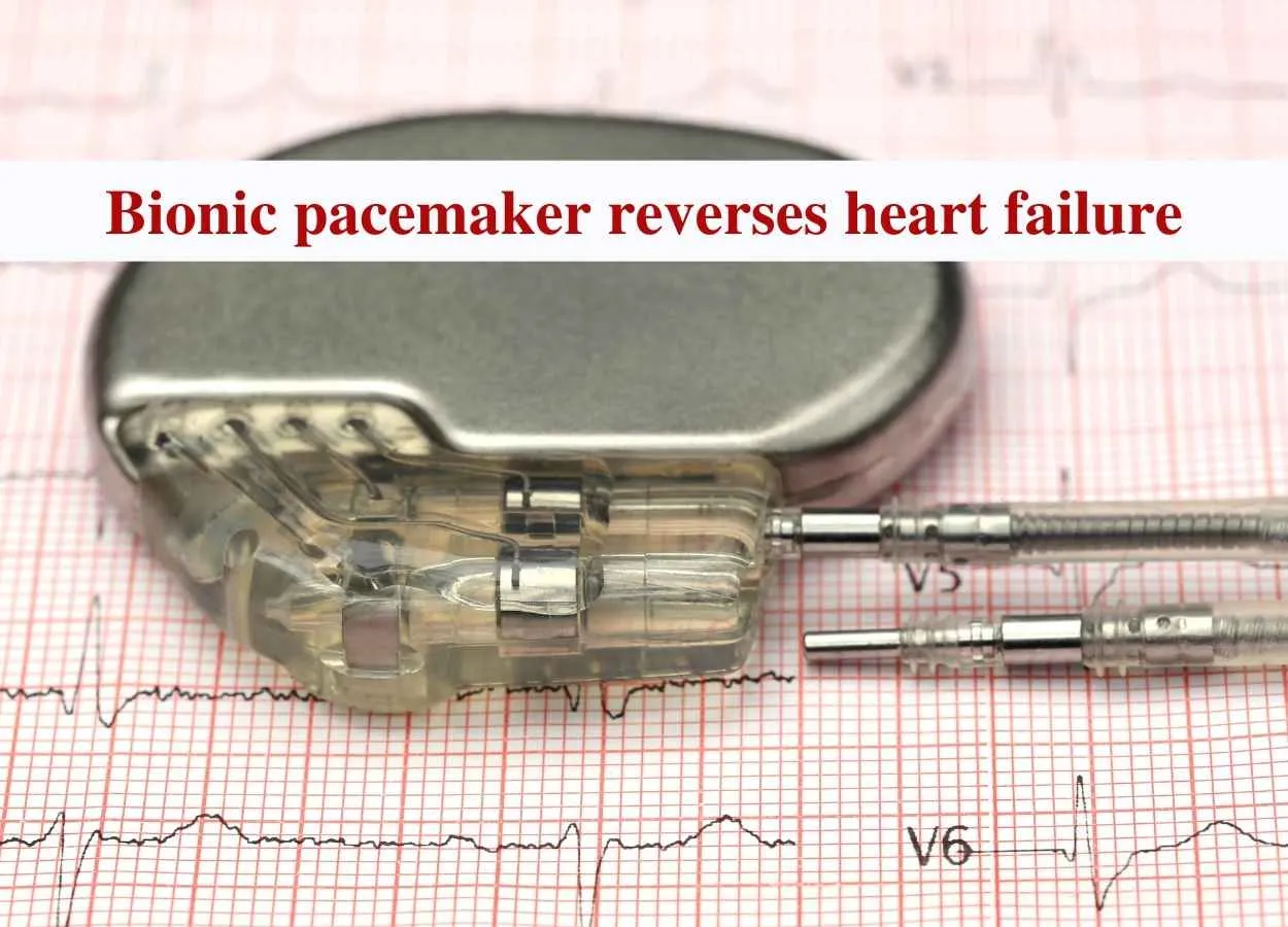 Bionic pacemaker reverses heart failure